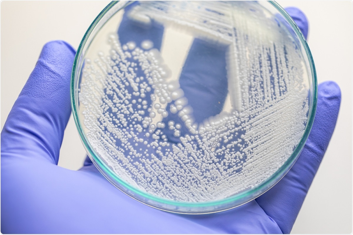 Study: Scalable, methanol-free production of the SARS-CoV-2 receptor binding domain in genetically modified Komagataella phaffii.  Photo credit: Rattiya Thongdumhyu / Shutterstock