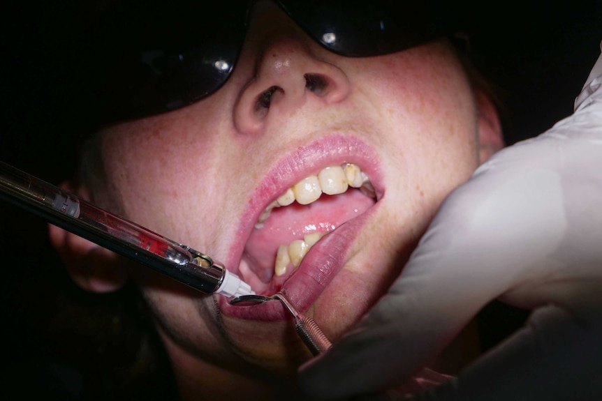 Close up of a woman's mouth being treated by a dentist.